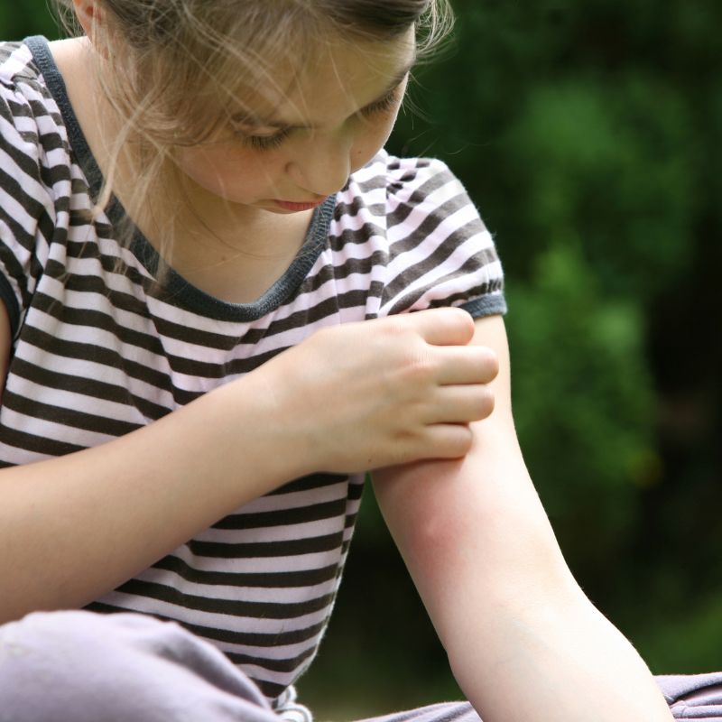 little girl with a striped shirt looking at a mosquito bite on her arm